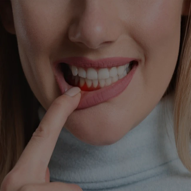 Periodontics services: Dental treatment for gum problems.
