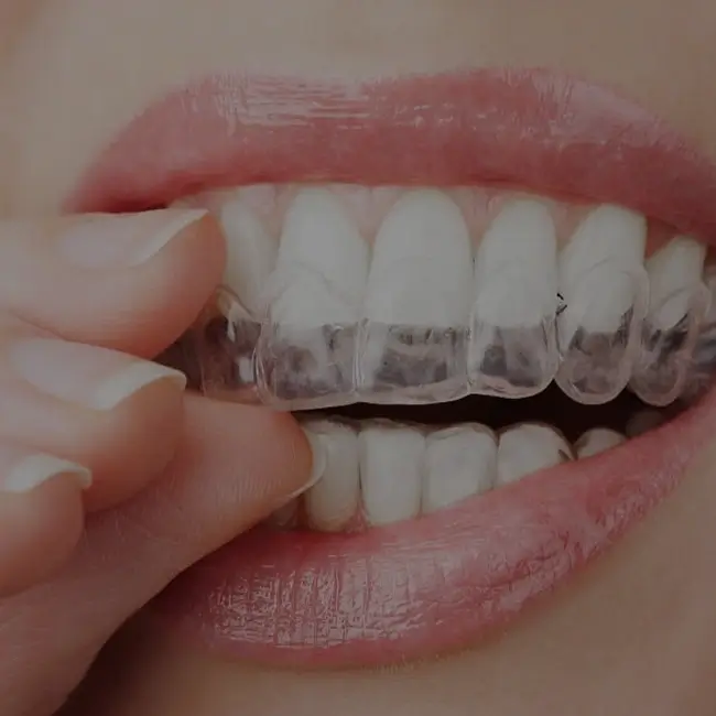 Cosmetic Dentistry services: A smiling patient after cosmetic dental treatment.